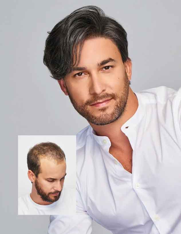 Men's non-surgical hair replacement Washington Utah - Zion Hair Restoration